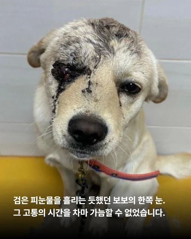 세이버즈가 만든 한쪽 눈의 기적 #위액트보보 현장 사진