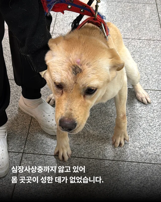 세이버즈가 만든 한쪽 눈의 기적 #위액트보보 현장 사진