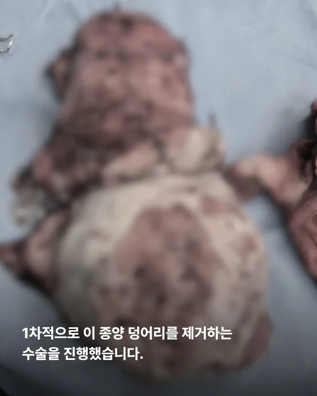 기적이가 깨어났습니다. 현장 사진