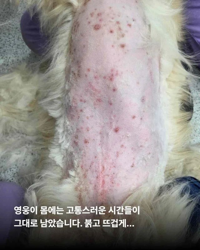 뜨겁게 몸에 새겨진 버림받은 시간들 현장 사진