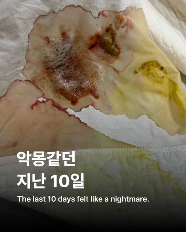 위액트에게 지난 10일은 정말 악몽 같은 시간이었습니.. 현장 사진