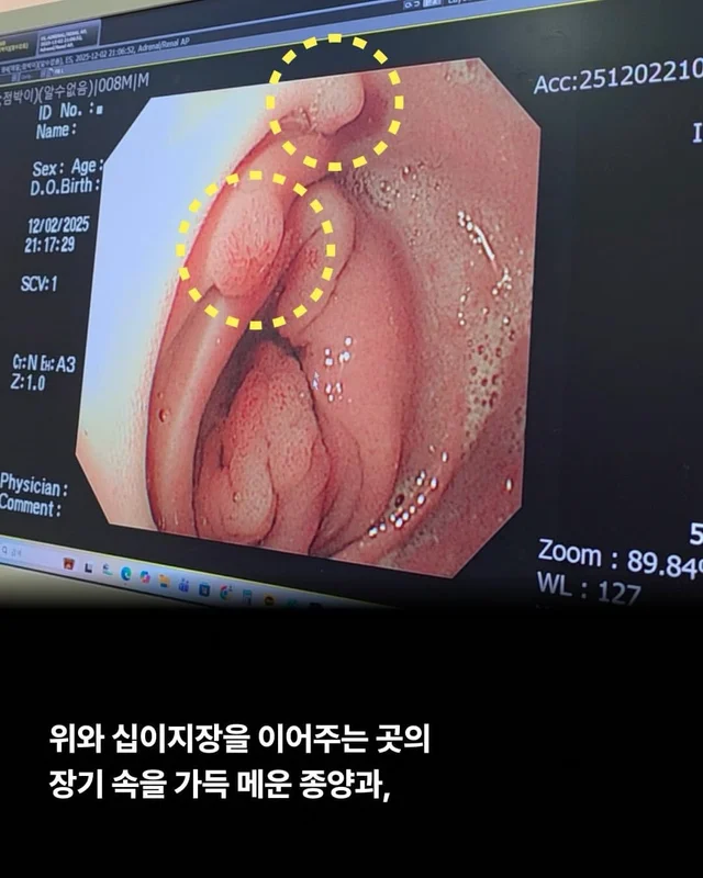 위액트에게 지난 10일은 정말 악몽 같은 시간이었습니.. 현장 사진