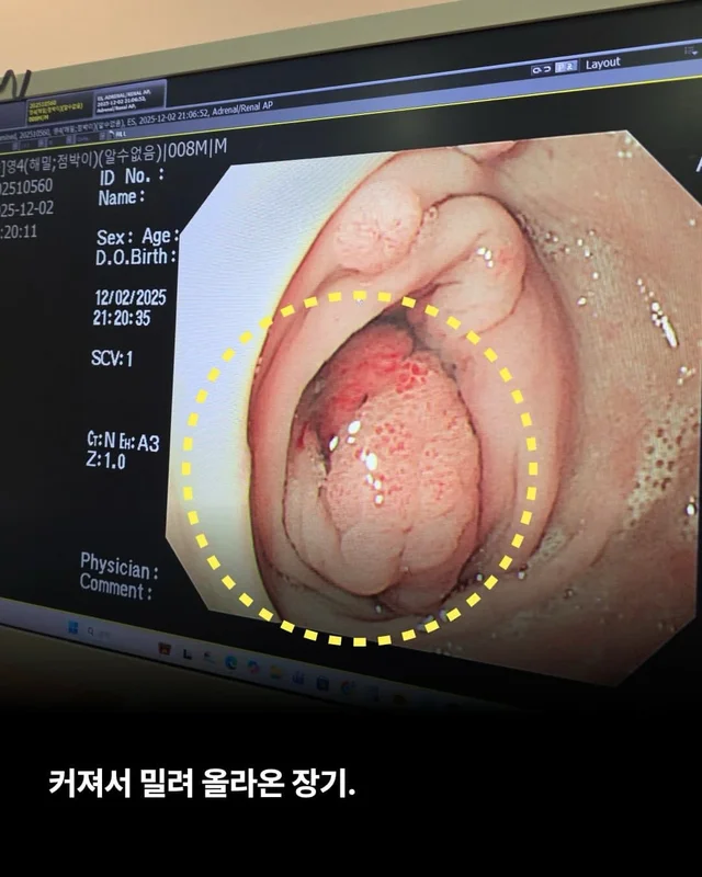 위액트에게 지난 10일은 정말 악몽 같은 시간이었습니.. 현장 사진
