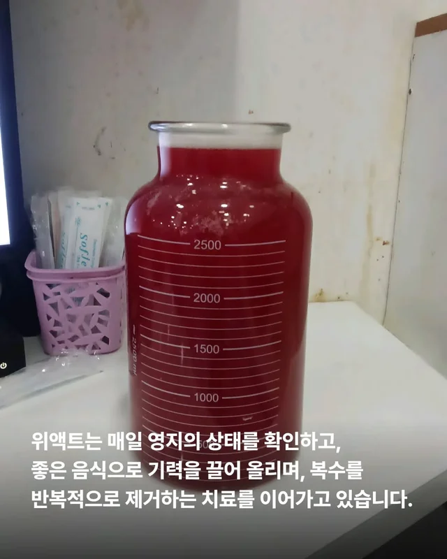 복수를 빼고, 차오르고, 또 빼고... #위액트영지 현장 사진